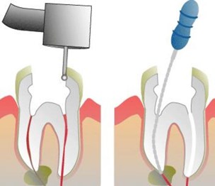 Steven E. Penn, DDS