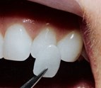 Best_Dentists_In_Carson_CA.jpg