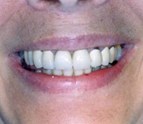 Richard_Wilson_D_D_S_Emergency_Dentist_3.jpg