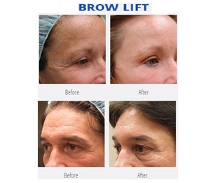 The Langdon Center for Laser & Cosmetic Surgery