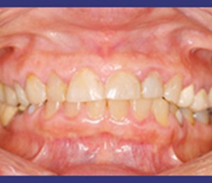 Concerned Dental Care of the Bronx