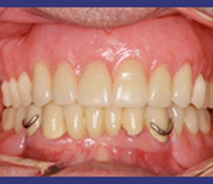 Concerned Dental Care of the Bronx