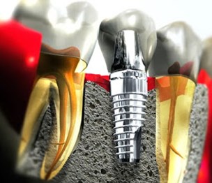 Dr. Joseph Lee, DDS - Mountain View Family & Cosme