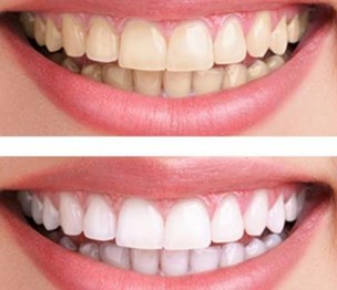 Healthy Smile Dental Care