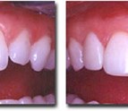 Dental_Care_in_Westlake_OH.jpg