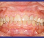 Dentist_in_Bronx_NY.jpg
