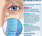 Eye_Clinic_Anaheim_Hills_CA.jpg