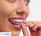 Joseph_Lee_DDS_Mountain_View_Family_Cosmetic_Dentistry_Sedation.jpg