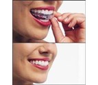 Preventive_Dentistry_Rehabilitative_Restorative_Cosmetic_Dentist_in_New_York_NY_8.jpg