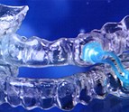 Sleep_Apnea_Mouth_Piece_Hampton_VA.jpg
