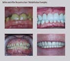 Smile_Makeovers_Hampton_VA.jpg