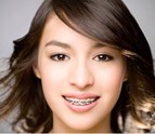 ZOOM_Teeth_Whitening_Bryan_TX.jpg