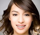 ZOOM_Teeth_Whitening_Tomball_TX.jpg