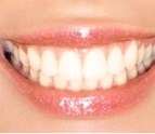 general_dentistry_cosmetic_dentistry_orthodontics_in_Oconomowoc_WI_11.jpg