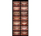 general_dentistry_cosmetic_dentistry_orthodontics_in_Oconomowoc_WI_12.jpg